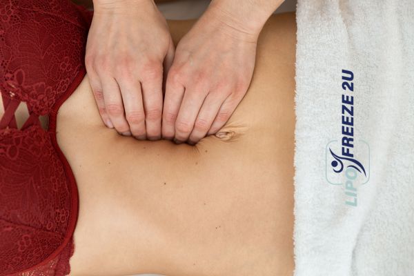 diastasis recti treatment Bognor Regis