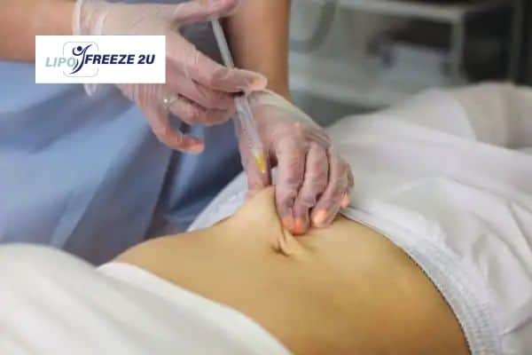 Fat Dissolving Injections Bognor Regis & Weight loss medication