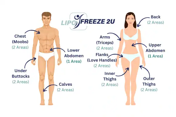 Areas you can have fat freezing treatment Bognor Regis
