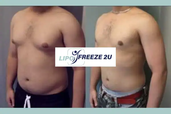 How Long Does It Take to See Results Bognor Regis?