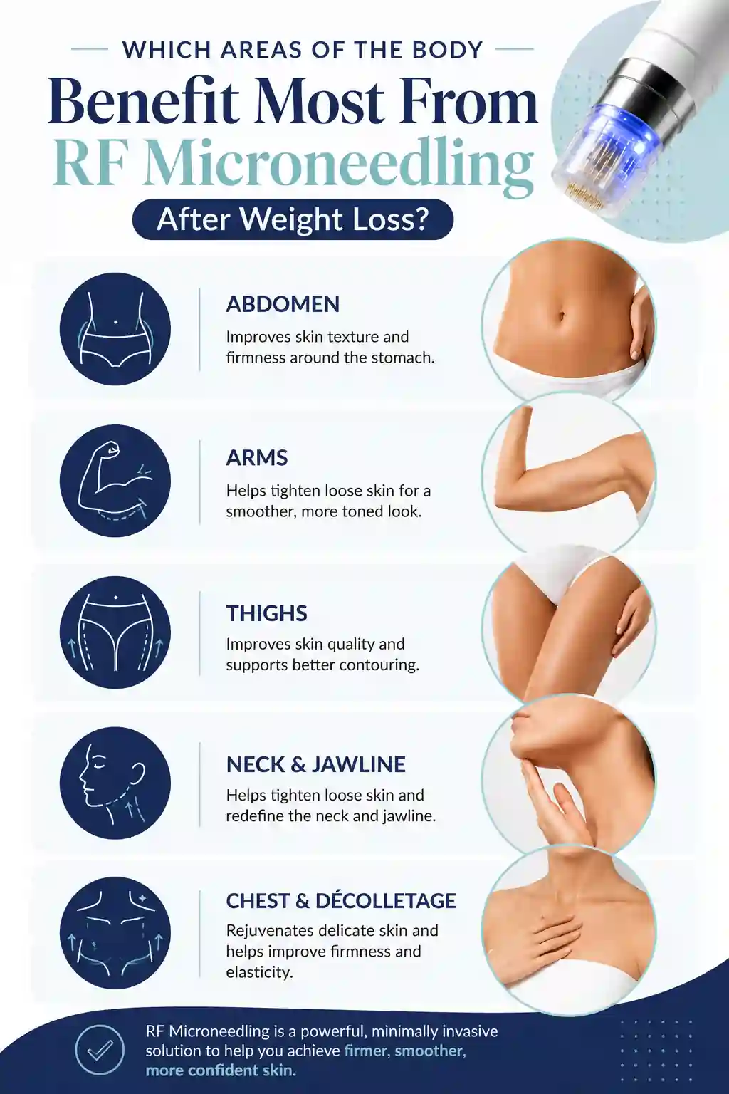 Which Areas of the Body Benefit Most From RF Microneedling After Weight Loss Bognor Regis